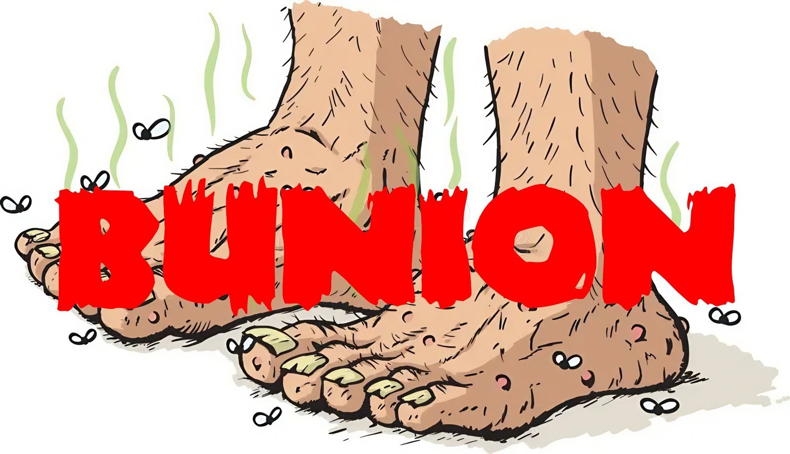 Bunion (1979)